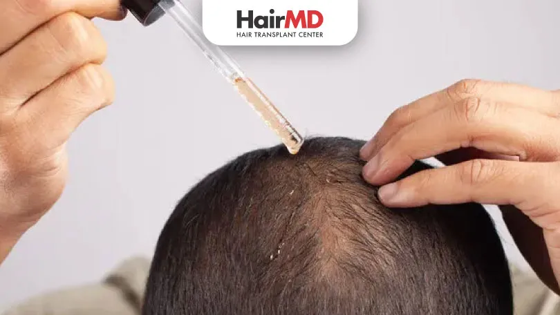 minoxidil 5 or 10 which is better for hair loss