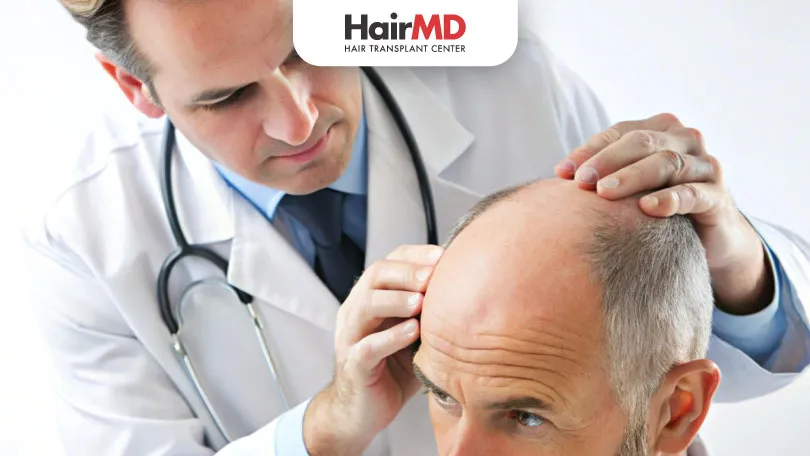 Expert Tips for Picking a Trusted Hair Transplant Doctor