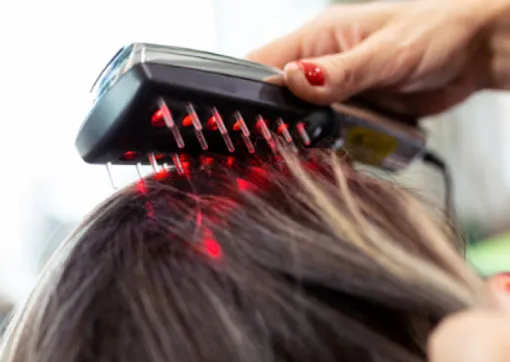 Advanced Laser Hair Restoration