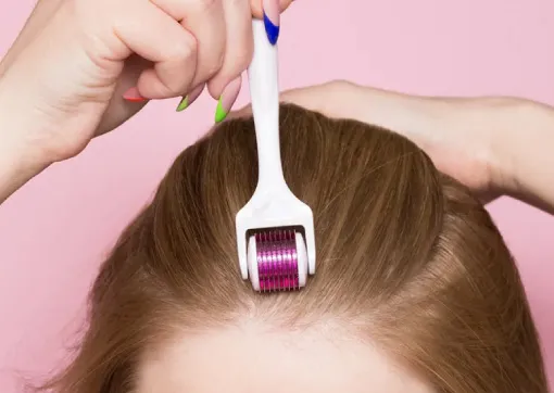 Dermaroller Treatment for Hair Loss