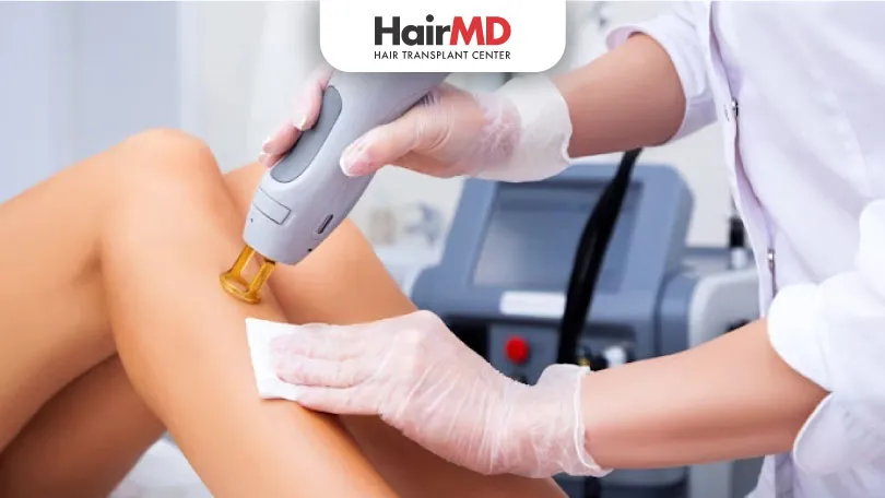 Does-laser-hair-removal-last-forever-HairMD-Pune