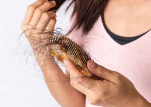 Excessive Hair Shedding