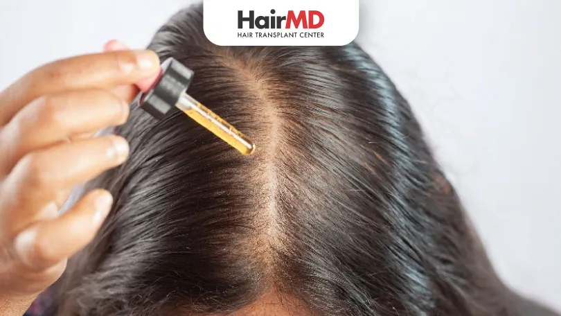 How-to-apply-minoxidil-and-hair-oil-together-HairMD-Pune