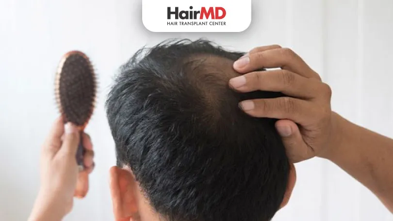 How to Prevent Hair Fall: Effective Tips to Save Your Hair