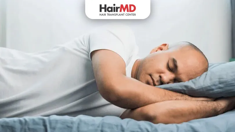 How to sleep after FUE hair transplant?