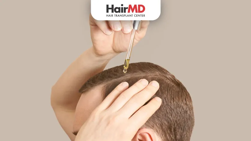 How to use Finasteride for hair loss? | HairMD