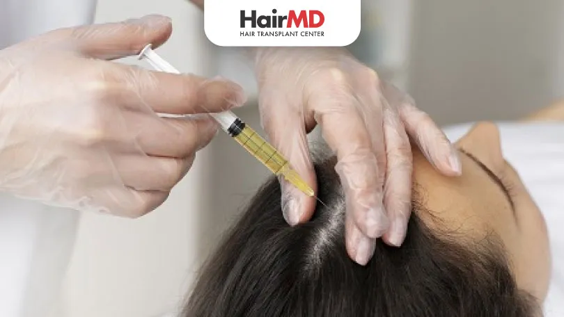 Know the Benefits of Mesotherapy for Hair Loss