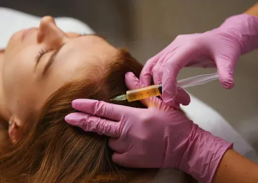 Mesotherapy Treatment