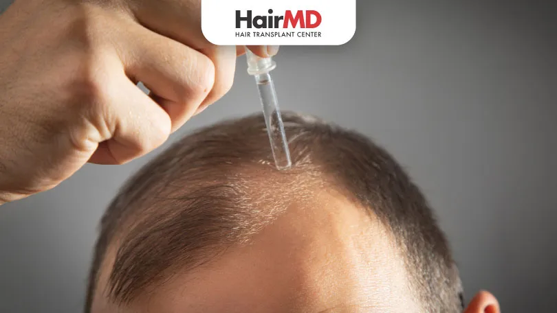 Minoxidil & Minoxidil, Finasteride for Hair Loss