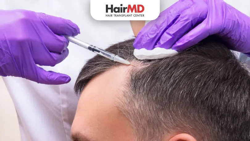 PRP-for-a-Receding-Hairline-Is-It-Effective-HairMD-Pune