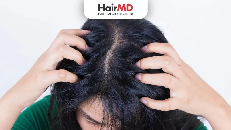 Scalp Sensitivity: Causes, Symptoms, Treatment & Hair Loss Connection