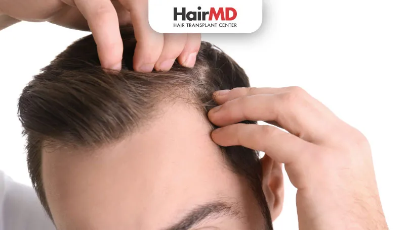 Sir-I-was-used-minoxidil-solution-for-2-months,-my-Hair-Loss-was-stopped