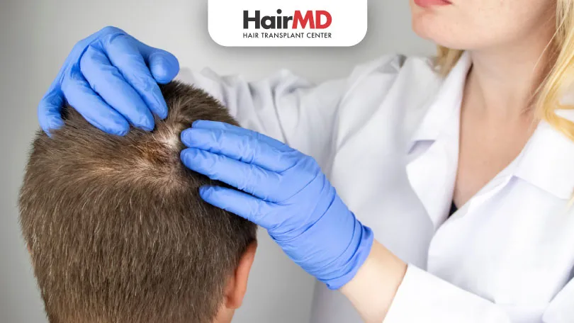 Treatment-for-Male-Hair-Loss-in-40’s-HairMD-Pune