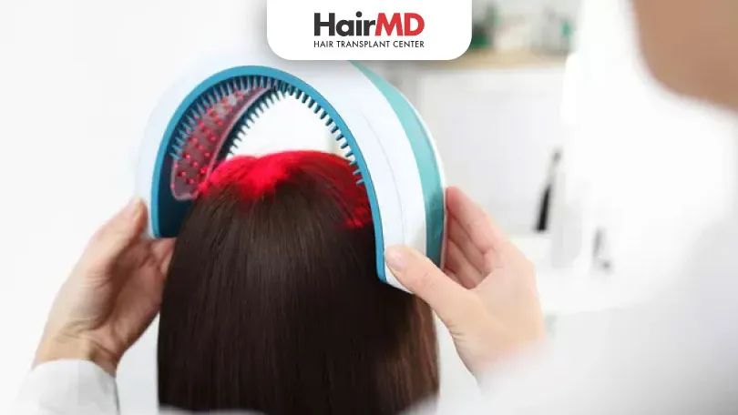 Low-Level Laser Therapy for Hair Loss | HairMD