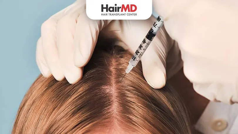 What is Mesotherapy for Hair Loss?