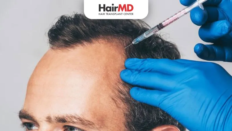 PRP treatment for hair loss