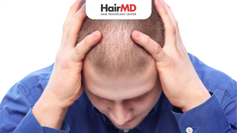 Relation Between Masturbation and Hair Loss