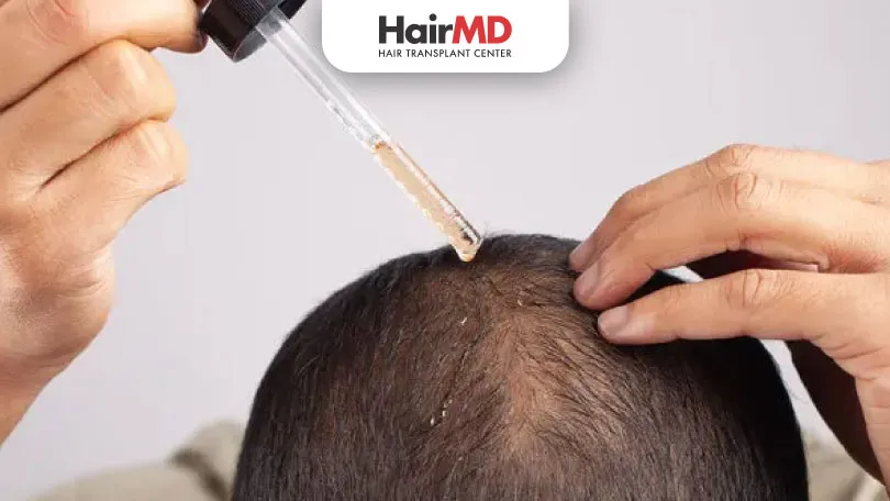 What is the best medication for hair loss?