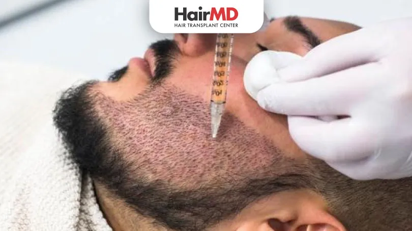 what-is-the-cost-of-beard-transplant-HairMD-Pune