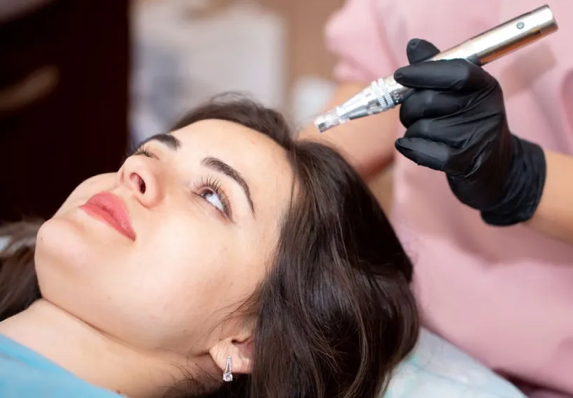 Dermapen Microneedling