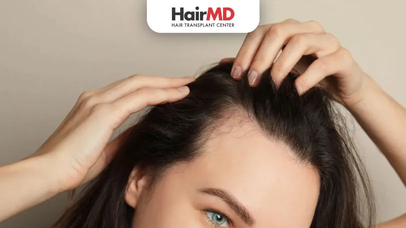 What are the Causes of Female Hair Loss HairMD Pune