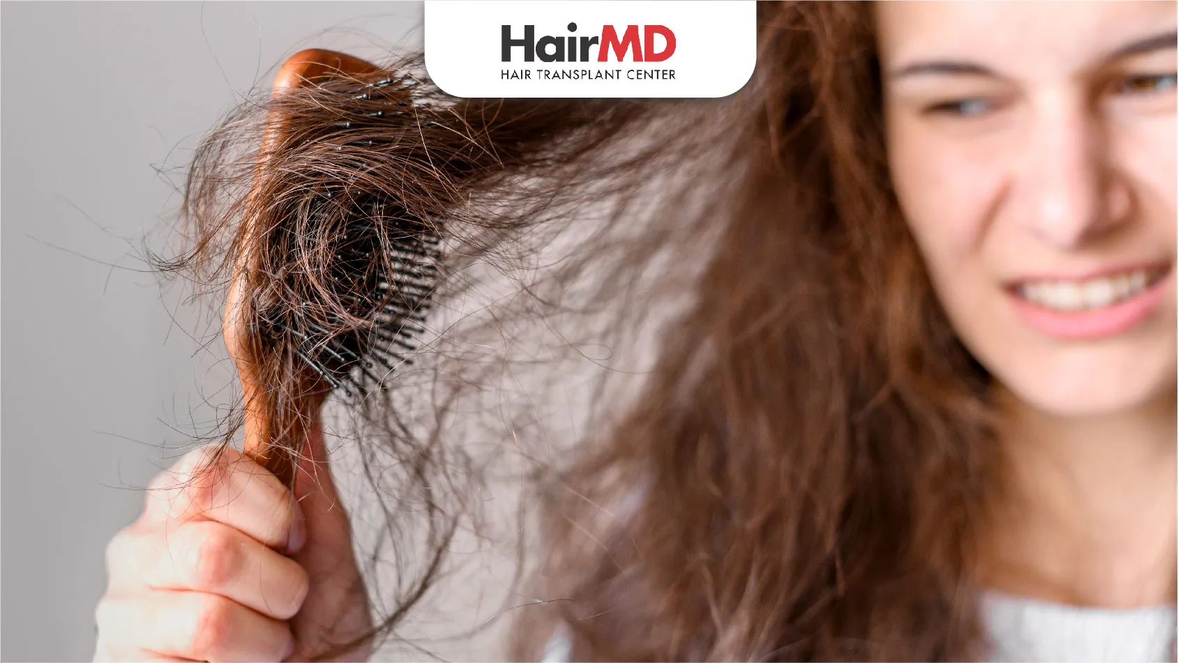 Top causes of hair loss in women