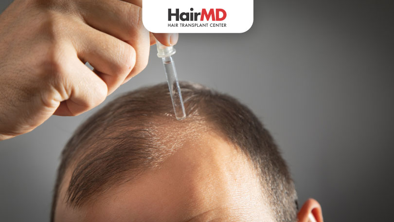 Topical Finasteride – A Revolutionary Approach to Hair Loss Treatment