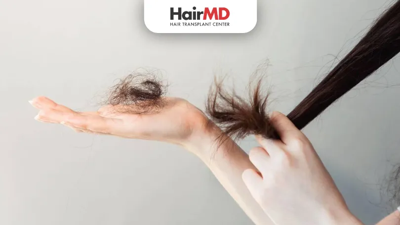 Trichotillomania-Causes,-Symptoms-&-Treatment-for-Hair-Pulling-Disorder